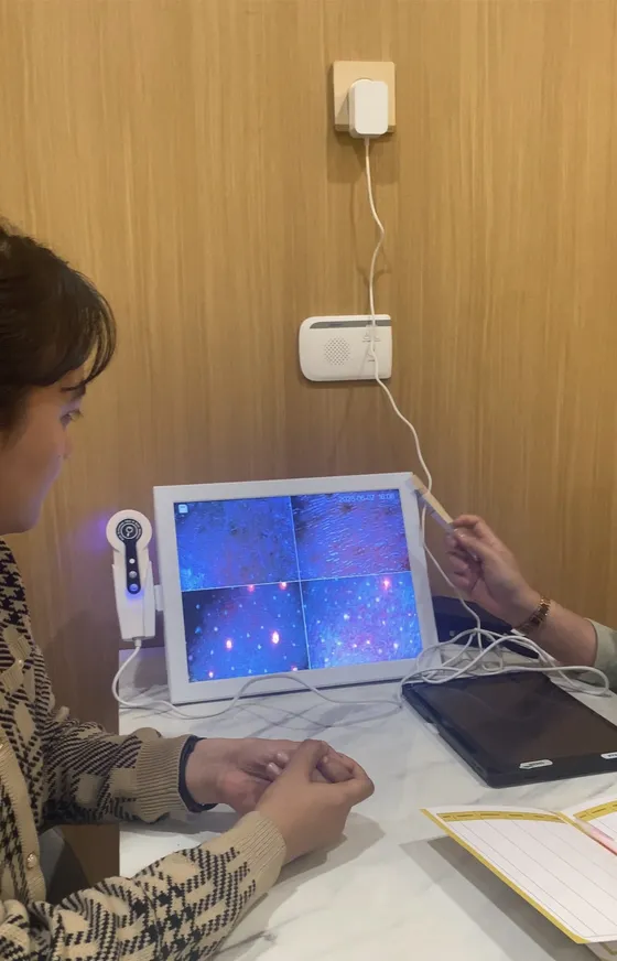 Skin analyzer
